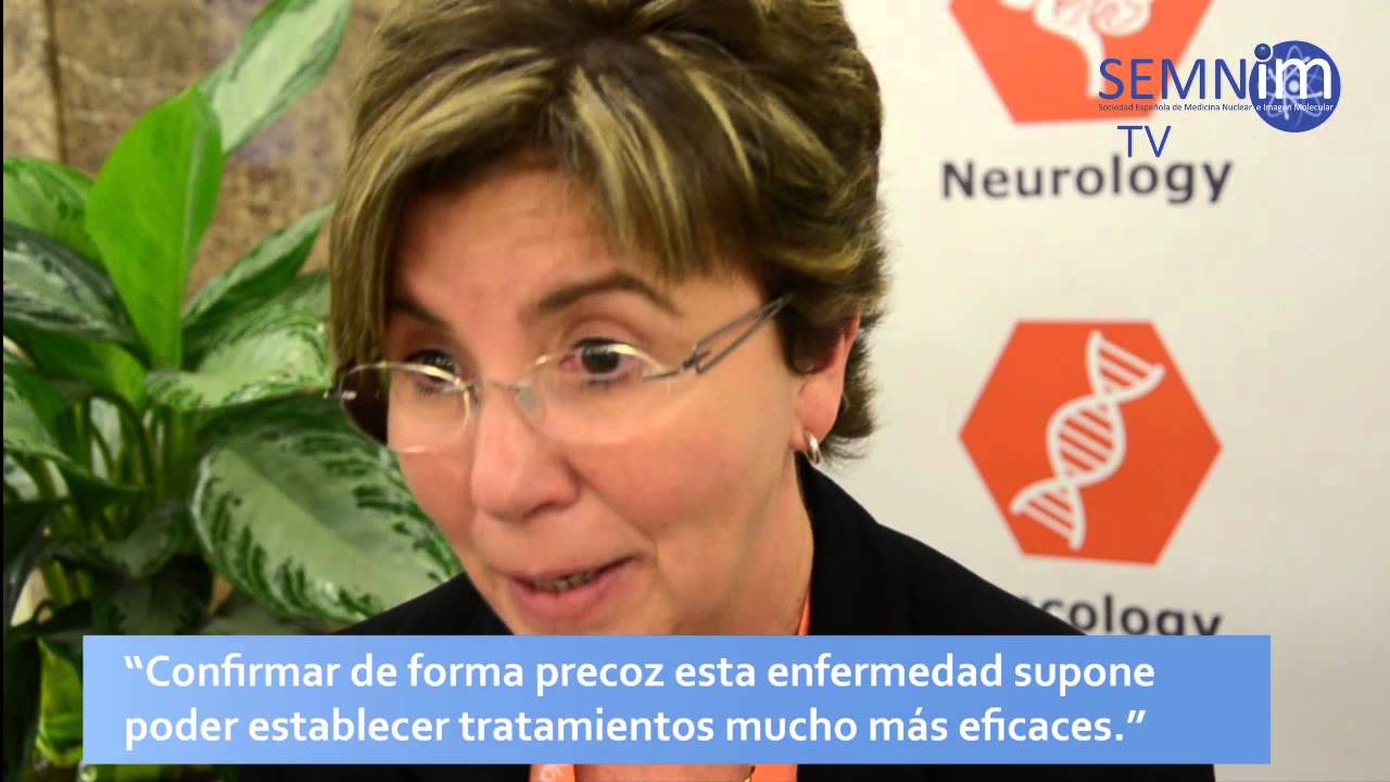 ¿Existen biomarcadores en las etapas previas del Alzheimer?